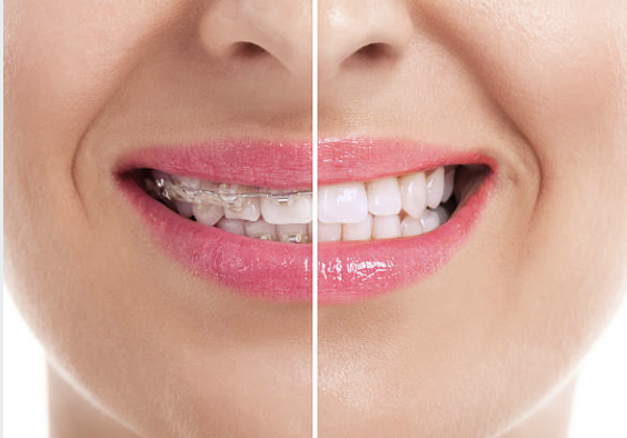 Patients NYDentistry