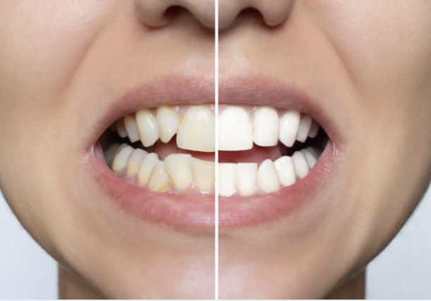 Patients NYDentistry