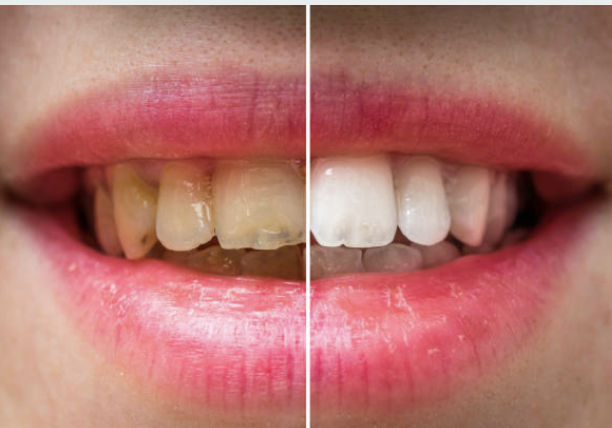 Patients NYDentistry